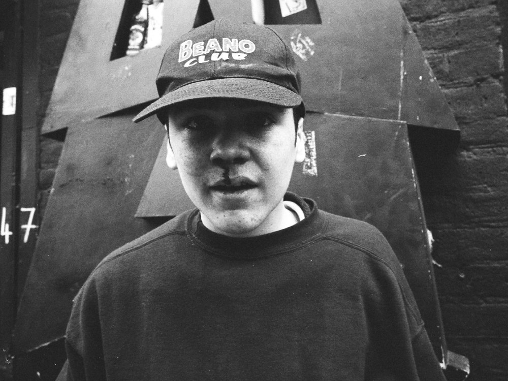 A young boy with a bloodied nose, wearing a jumper and a cap that says 'Beano Club'