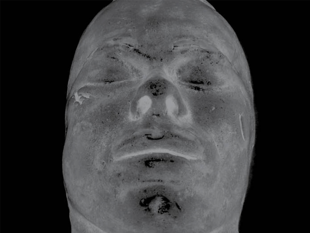 An x-ray of a corpse's face